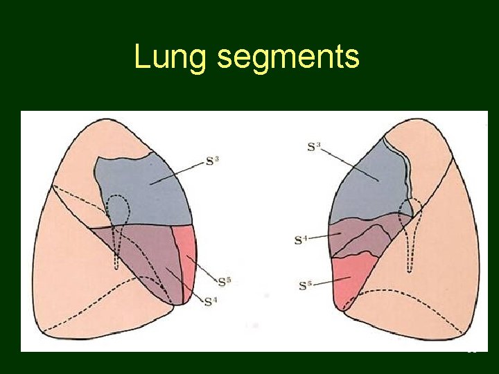 Lung segments 56 
