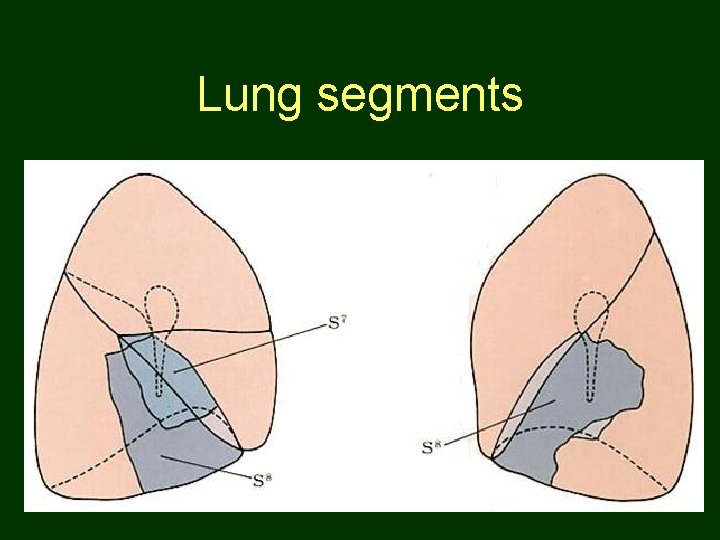 Lung segments 59 