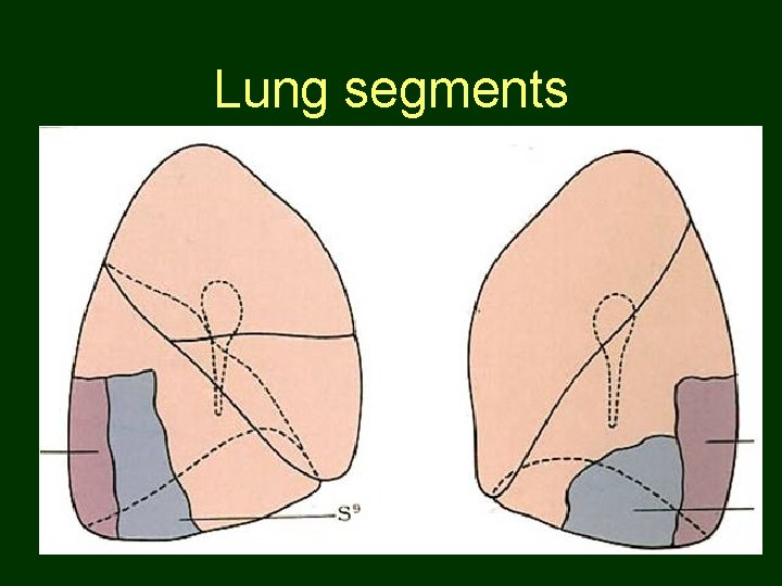 Lung segments 60 