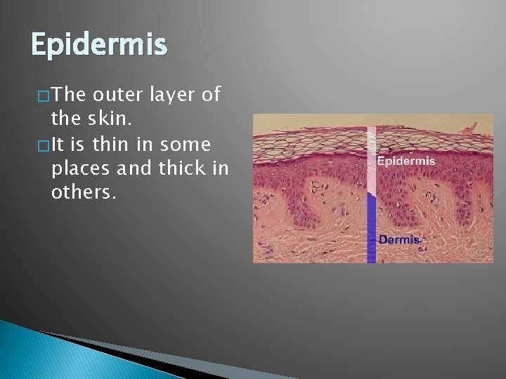 Epidermis � The outer layer of the skin. � It is thin in some