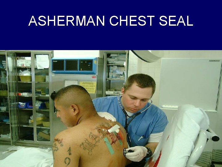 ASHERMAN CHEST SEAL 