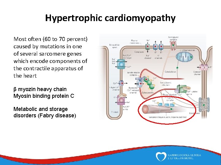 Hypertrophic cardiomyopathy Most often (60 to 70 percent) caused by mutations in one of