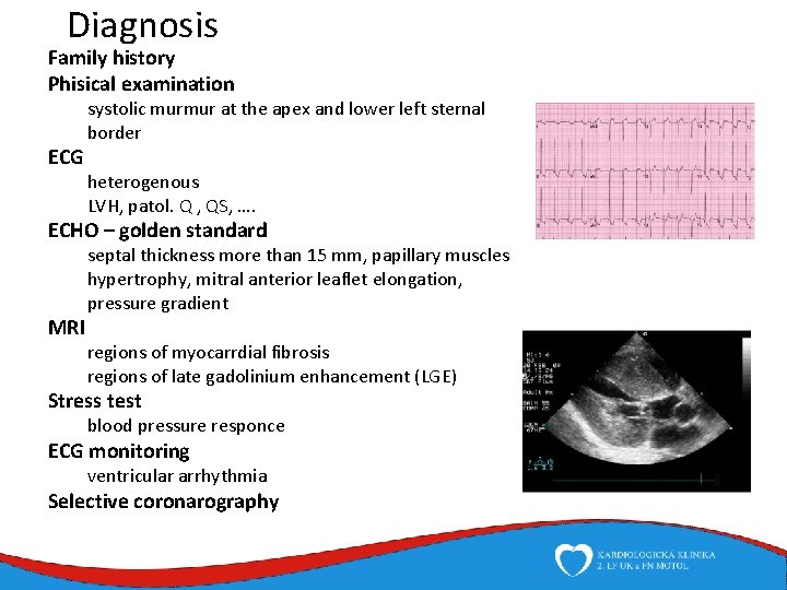 Diagnosis Family history Phisical examination ECG systolic murmur at the apex and lower left