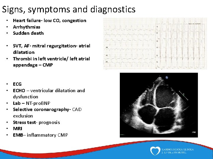 Signs, symptoms and diagnostics • Heart failure- low CO, congestion • Arrhythmias • Sudden
