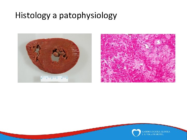 Histology a patophysiology 