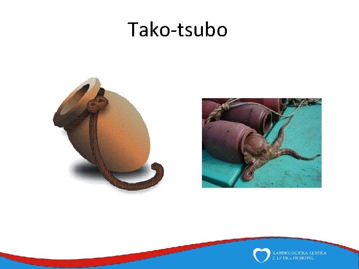 Tako-tsubo 