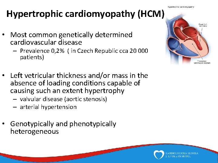 Hypertrophic cardiomyopathy (HCM) • Most common genetically determined cardiovascular disease – Prevalence 0, 2%