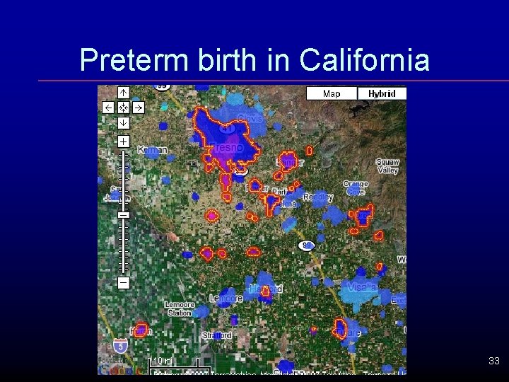 Preterm birth in California 33 