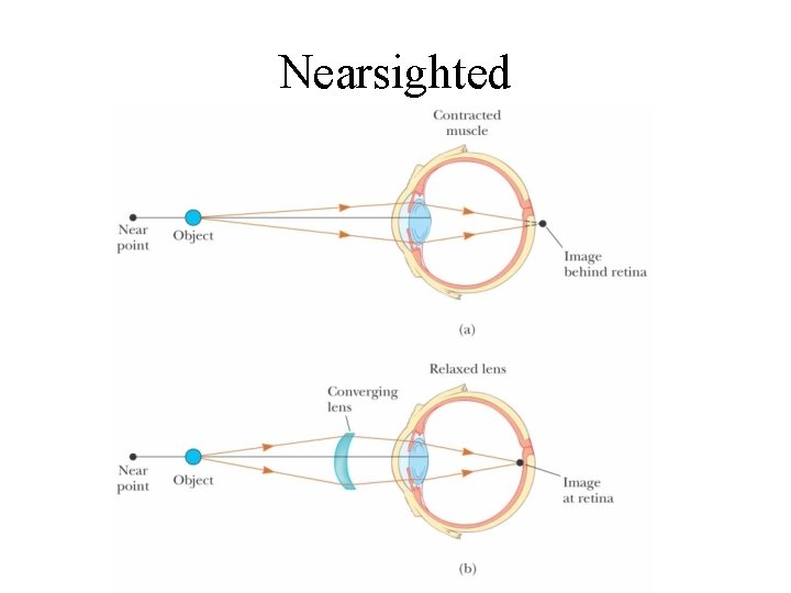 Nearsighted 
