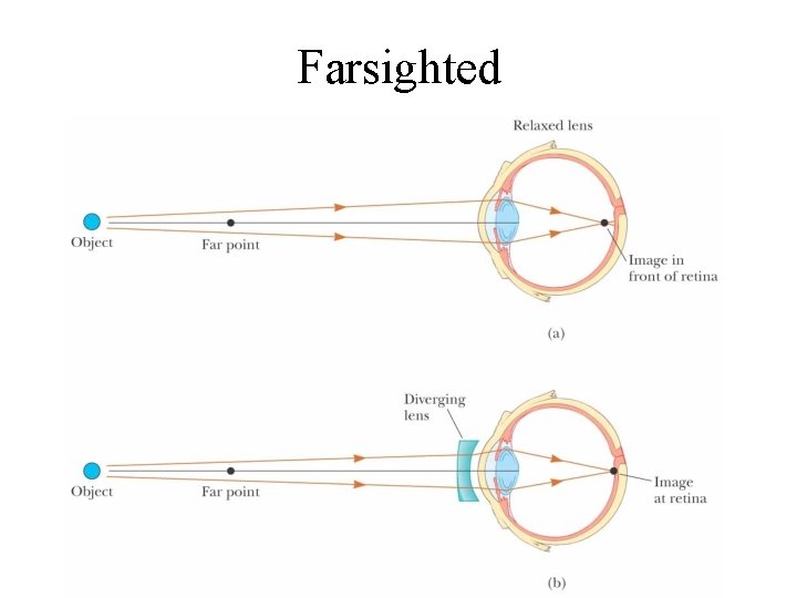 Farsighted 