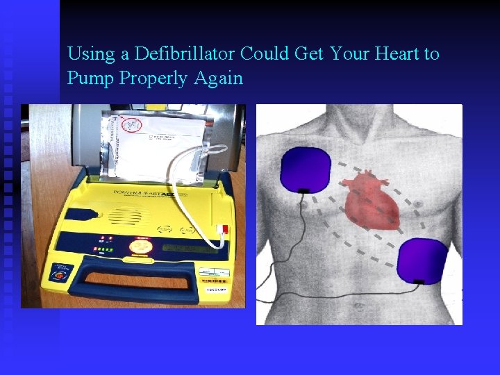 Using a Defibrillator Could Get Your Heart to Pump Properly Again 