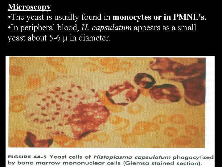 Microscopy • The yeast is usually found in monocytes or in PMNL's. • In