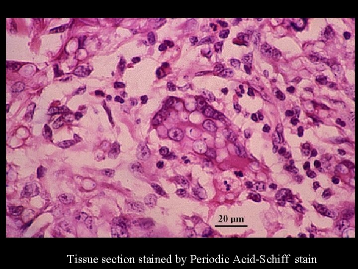 Tissue section stained by Periodic Acid-Schiff stain 