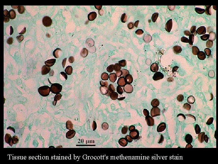 Tissue section stained by Grocott's methenamine silver stain 