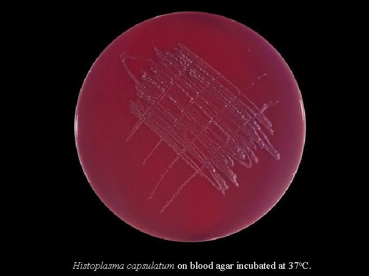 Histoplasma capsulatum on blood agar incubated at 37 o. C. 
