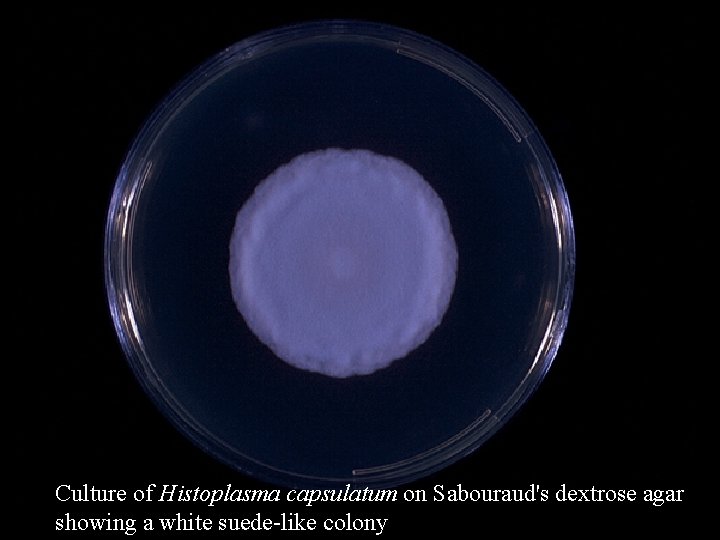 Culture of Histoplasma capsulatum on Sabouraud's dextrose agar showing a white suede-like colony 