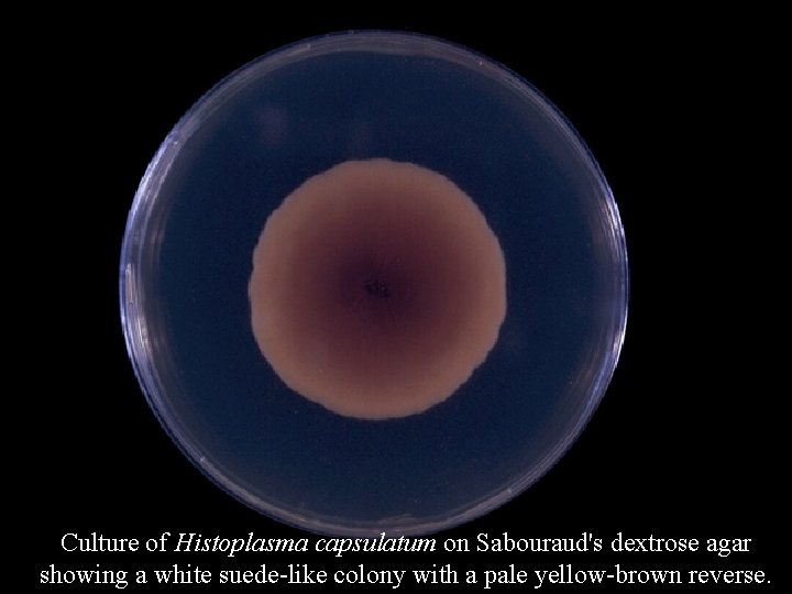 Culture of Histoplasma capsulatum on Sabouraud's dextrose agar showing a white suede-like colony with