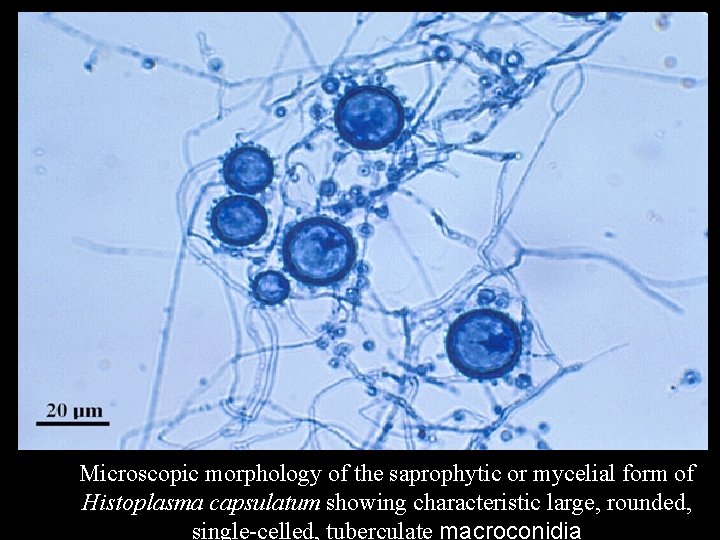 Microscopic morphology of the saprophytic or mycelial form of Histoplasma capsulatum showing characteristic large,