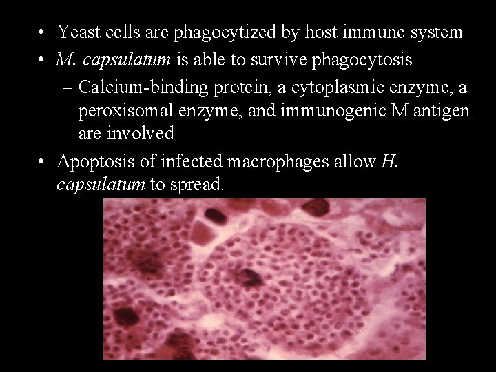  • Yeast cells are phagocytized by host immune system • M. capsulatum is