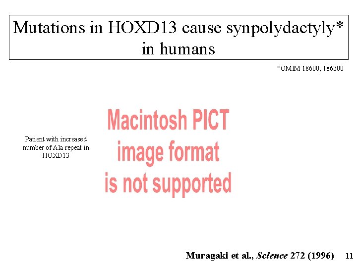 Mutations in HOXD 13 cause synpolydactyly* in humans *OMIM 18600, 186300 Patient with increased