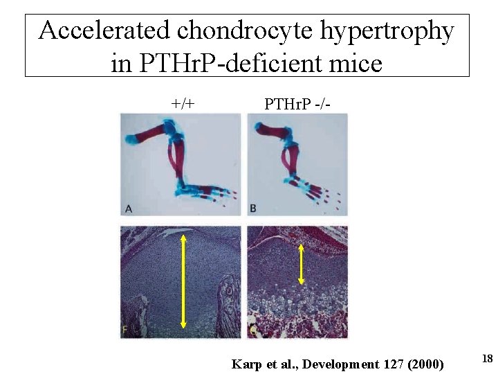 Accelerated chondrocyte hypertrophy in PTHr. P-deficient mice +/+ PTHr. P -/- Karp et al.