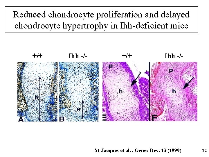 Reduced chondrocyte proliferation and delayed chondrocyte hypertrophy in Ihh-deficient mice +/+ Ihh -/- St-Jacques