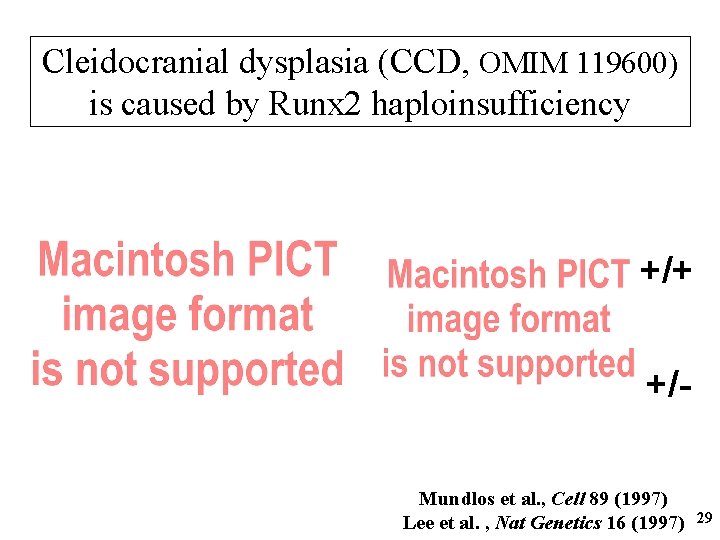 Cleidocranial dysplasia (CCD, OMIM 119600) is caused by Runx 2 haploinsufficiency +/+ +/Mundlos et