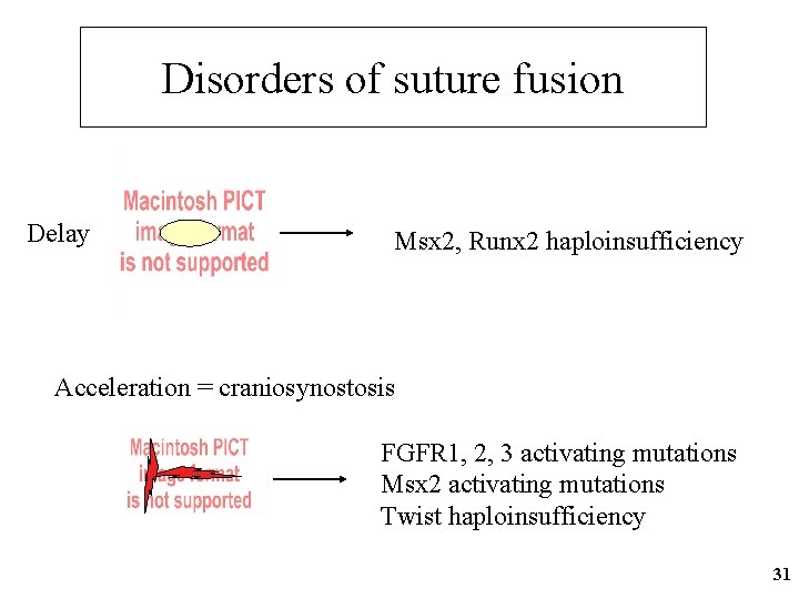 Disorders of suture fusion Delay Msx 2, Runx 2 haploinsufficiency Acceleration = craniosynostosis FGFR