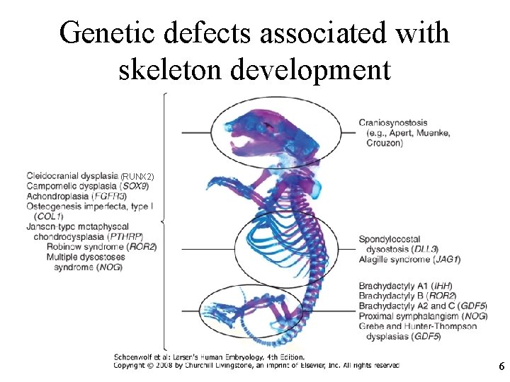 Genetic defects associated with skeleton development (RUNX 2) 6 