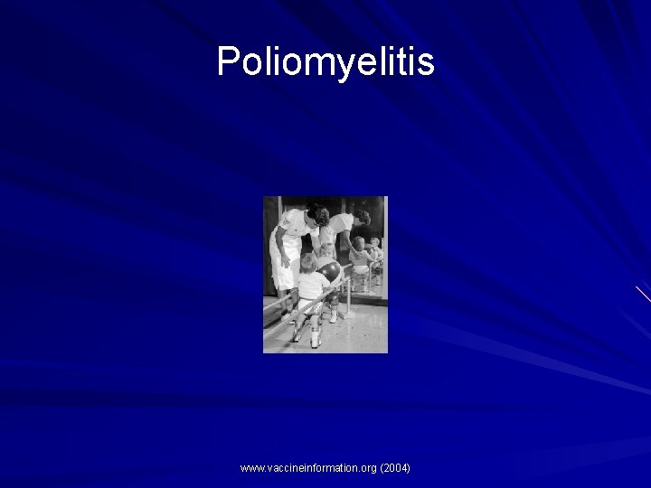 Poliomyelitis www. vaccineinformation. org (2004) Poliomyelitis www. vaccineinformation. org (2004)