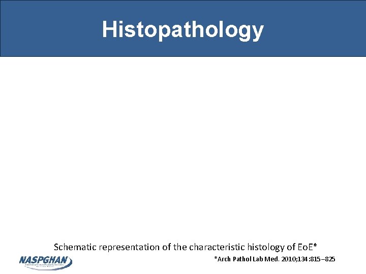 Histopathology Schematic representation of the characteristic histology of Eo. E* *Arch Pathol Lab Med. Histopathology Schematic representation of the characteristic histology of Eo. E* *Arch Pathol Lab Med.