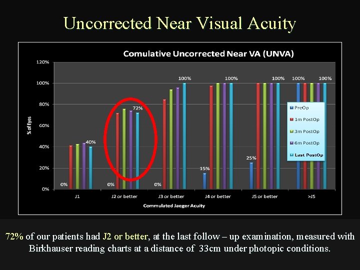 Uncorrected Near Visual Acuity 72% of our patients had J 2 or better, at