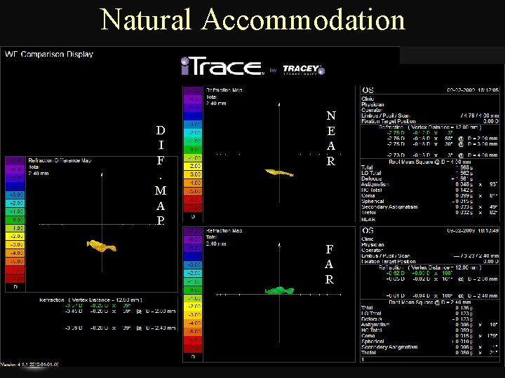 Natural Accommodation D I F. M A P N E A R F A