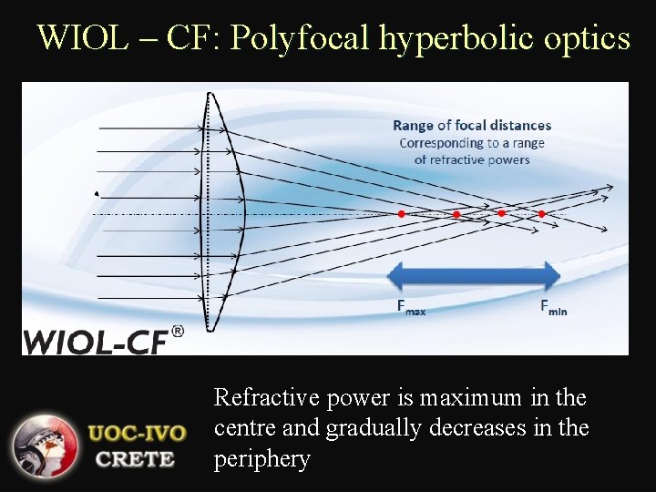 WIOL – CF: Polyfocal hyperbolic optics Refractive power is maximum in the centre and