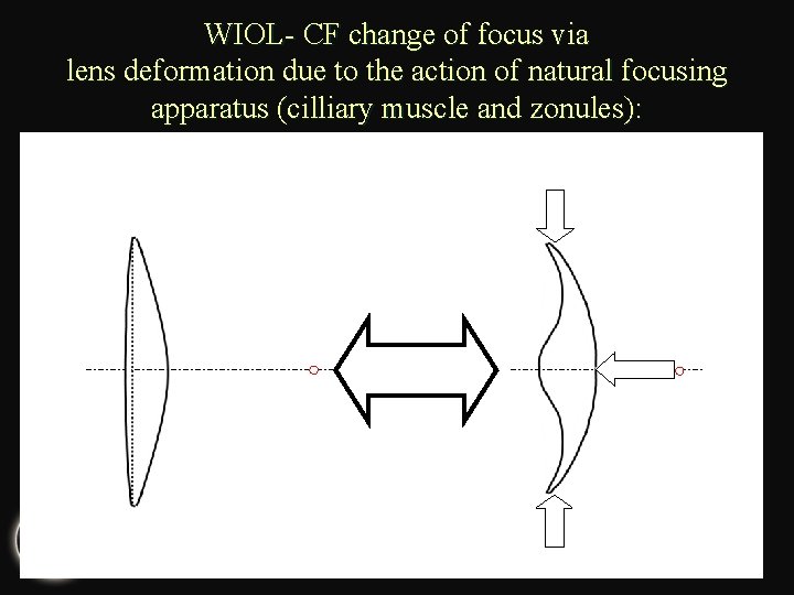 WIOL- CF change of focus via lens deformation due to the action of natural