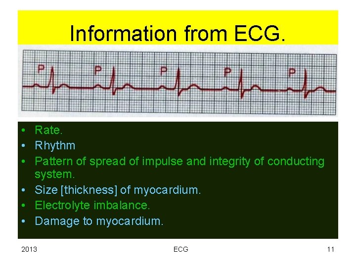 Information from ECG. • Rate. • Rhythm • Pattern of spread of impulse and