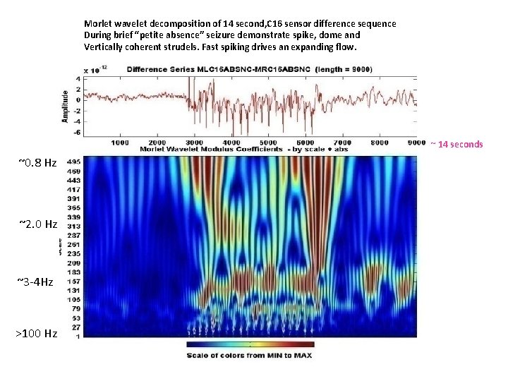 Morlet wavelet decomposition of 14 second, C 16 sensor difference sequence During brief “petite