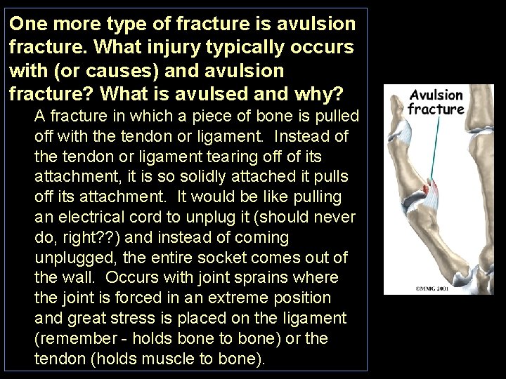 One more type of fracture is avulsion fracture. What injury typically occurs with (or