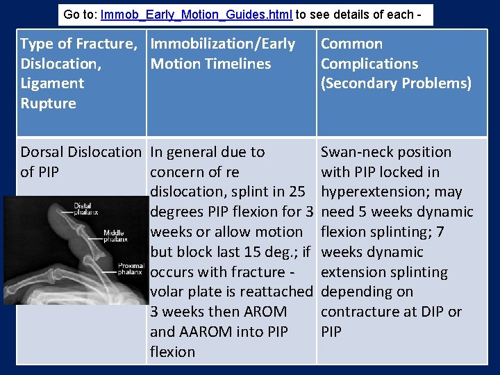 Go to: Immob_Early_Motion_Guides. html to see details of each - Type of Fracture, Immobilization/Early