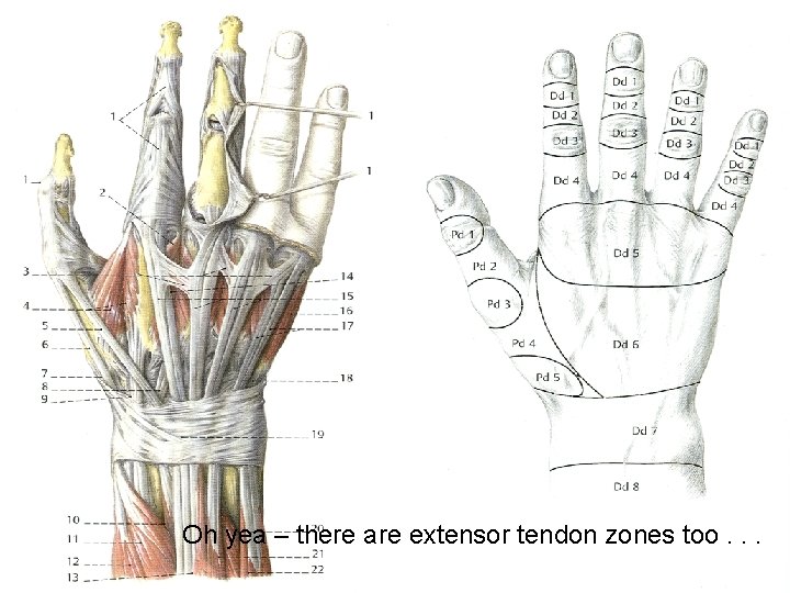 Oh yea – there are extensor tendon zones too. . . 