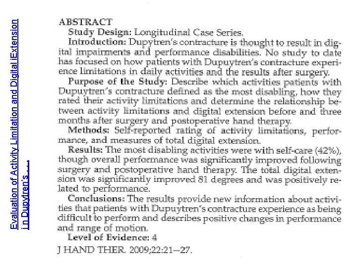 Evaluation of Activity Limitation and Digital i. Extension i n Dupytren’s. . . 