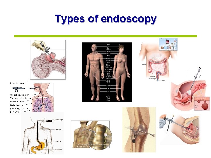 Types of endoscopy 