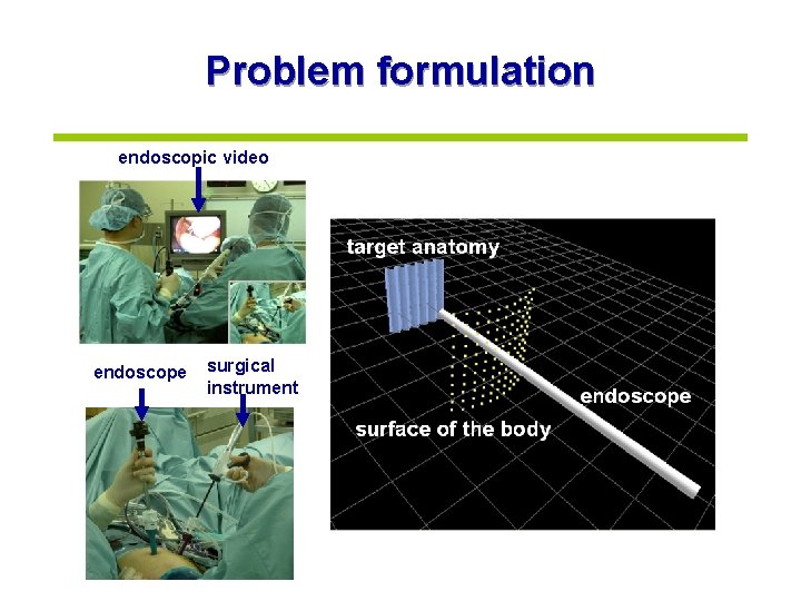 Problem formulation endoscopic video endoscope surgical instrument 
