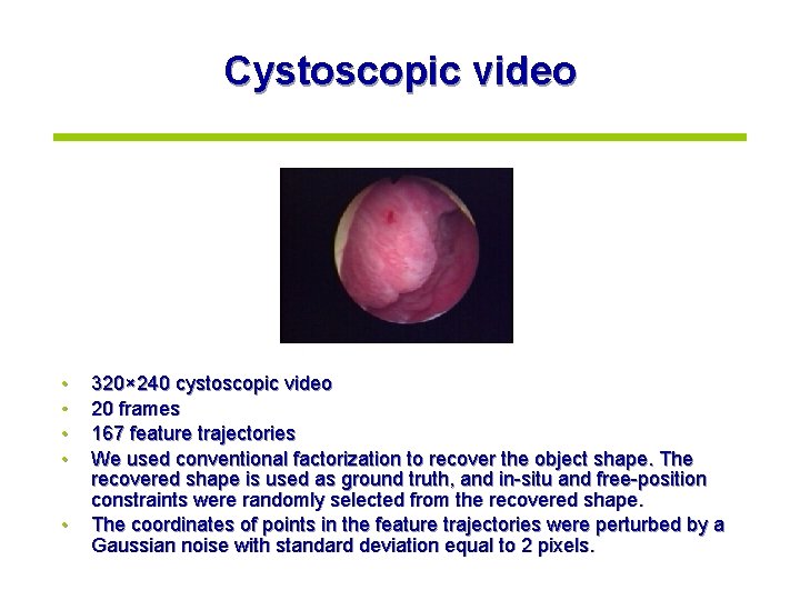 Cystoscopic video • • • 320× 240 cystoscopic video 20 frames 167 feature trajectories