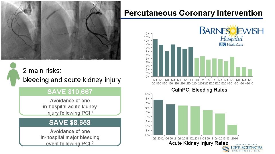 Draft for Discussion Purposes Percutaneous Coronary Intervention 12% 11% 10% 9% 8% 7% 6%