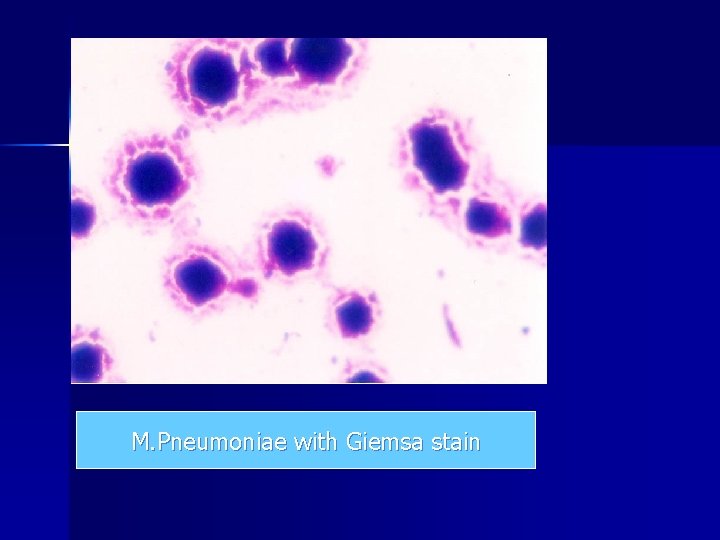 M. Pneumoniae with Giemsa stain M. Pneumoniae with Giemsa stain