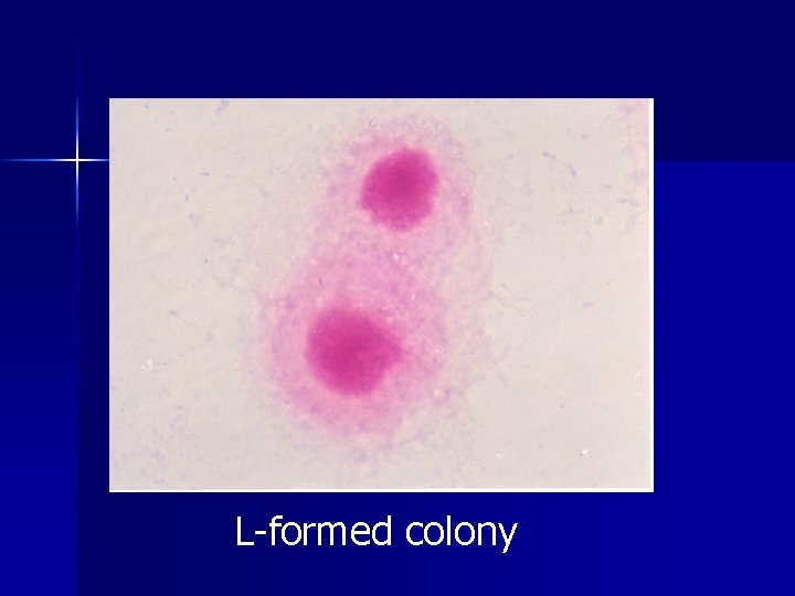 L-formed colony L-formed colony
