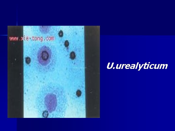 U. urealyticum U. urealyticum