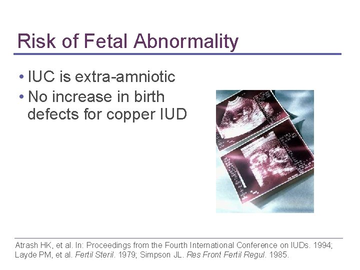 Risk of Fetal Abnormality • IUC is extra-amniotic • No increase in birth defects Risk of Fetal Abnormality • IUC is extra-amniotic • No increase in birth defects