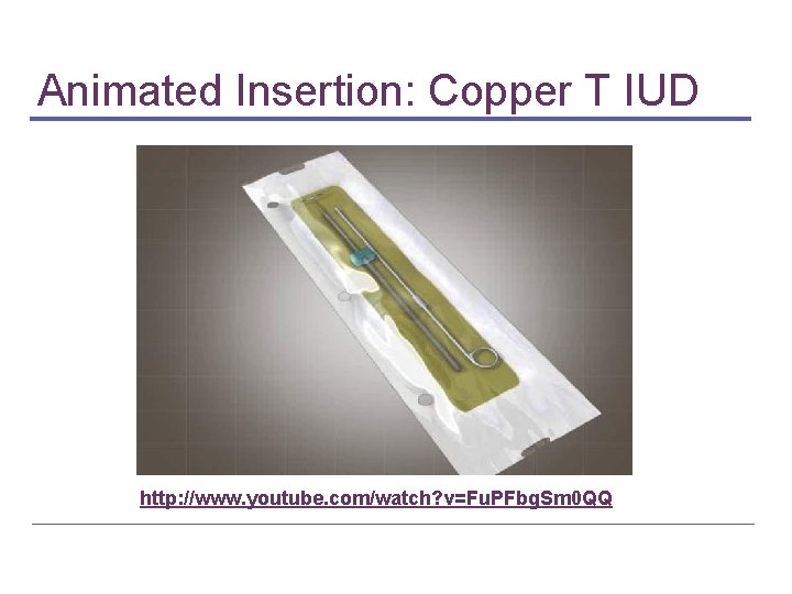 Animated Insertion: Copper T IUD http: //www. youtube. com/watch? v=Fu. PFbg. Sm 0 QQ Animated Insertion: Copper T IUD http: //www. youtube. com/watch? v=Fu. PFbg. Sm 0 QQ
